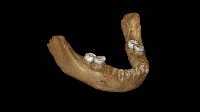 Virtual computer reconstruction of the Xiahe mandible, with layer of carbonate crust digitally removed.